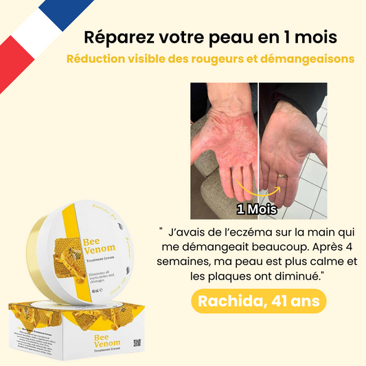 Bee Venom : Votre alliée contre les rougeurs et les crises de peau